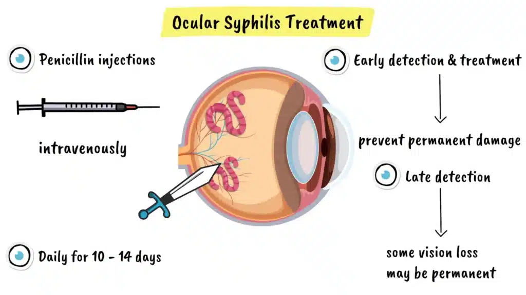 Treatment of Ocular Syphilis