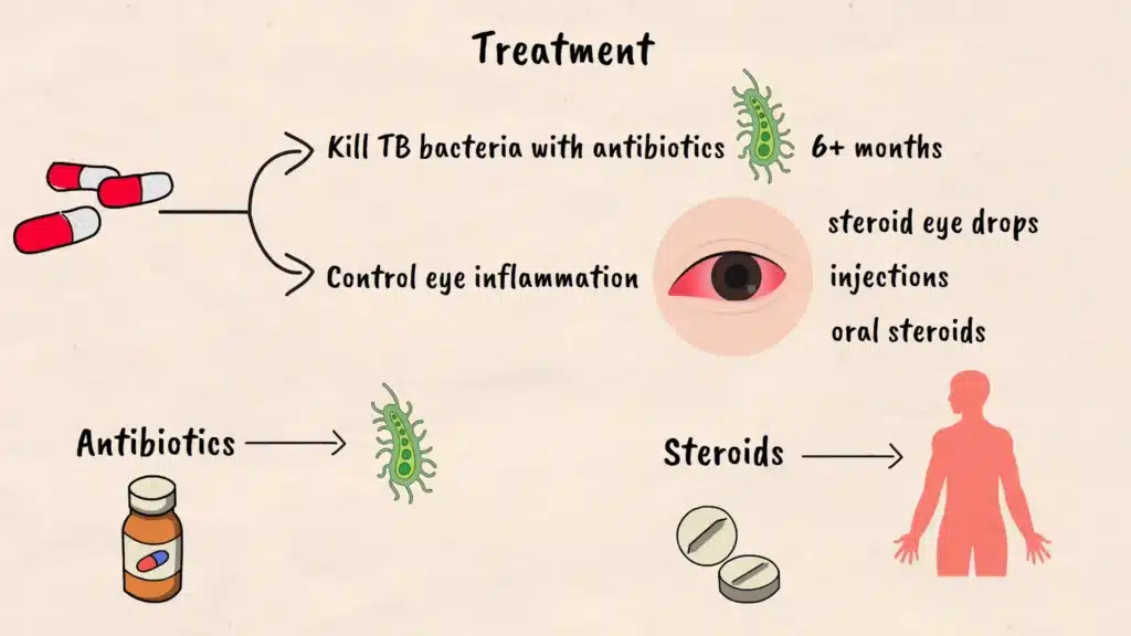 Treatment of Tuberculosis