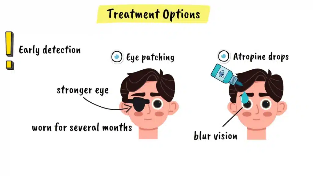 Treatment options for Amblyopia eye patching and atropine drops