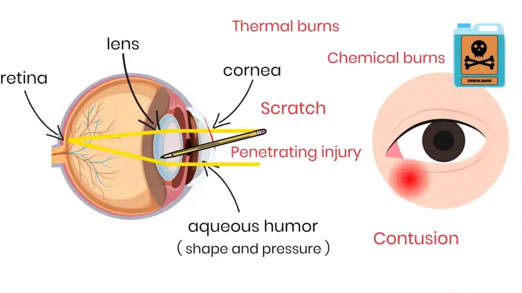 Understanding Eye Anatomy