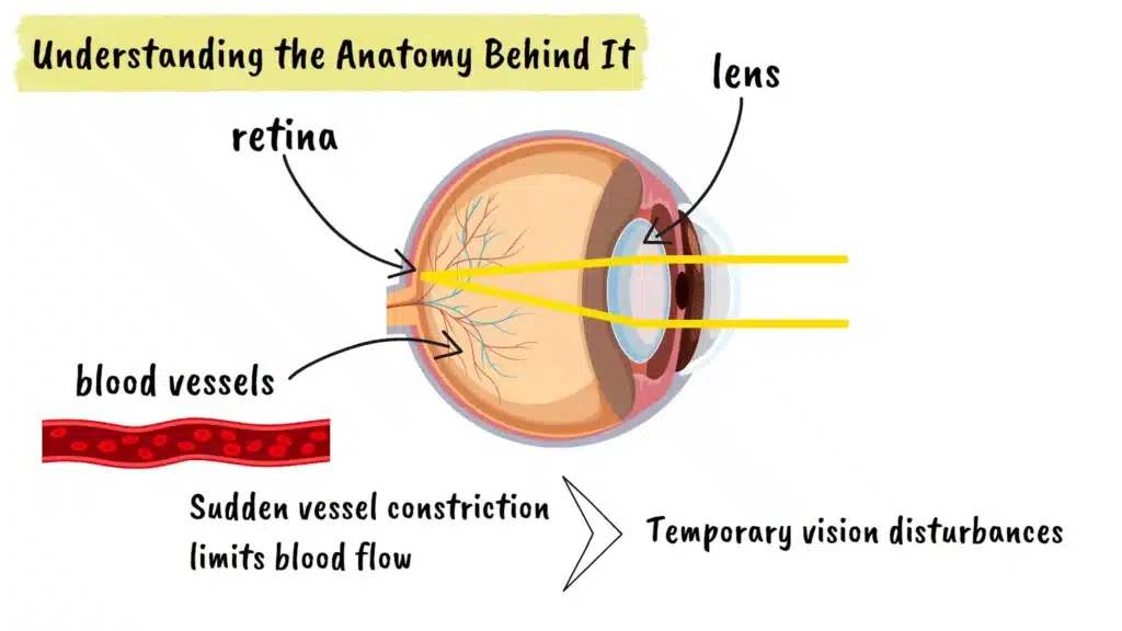Understanding the anatomy of Ocular Migraine