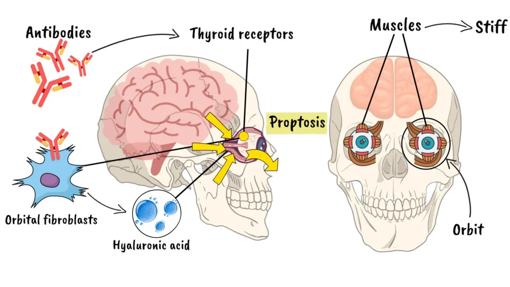 What Happens Inside Your Eye Socket