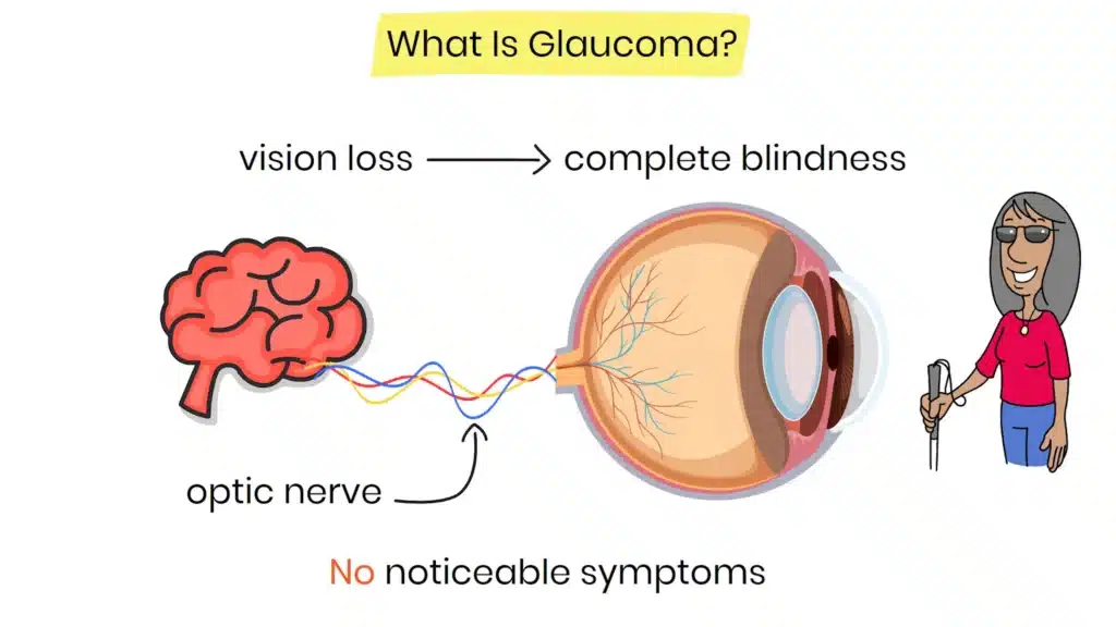 What is Glaucoma