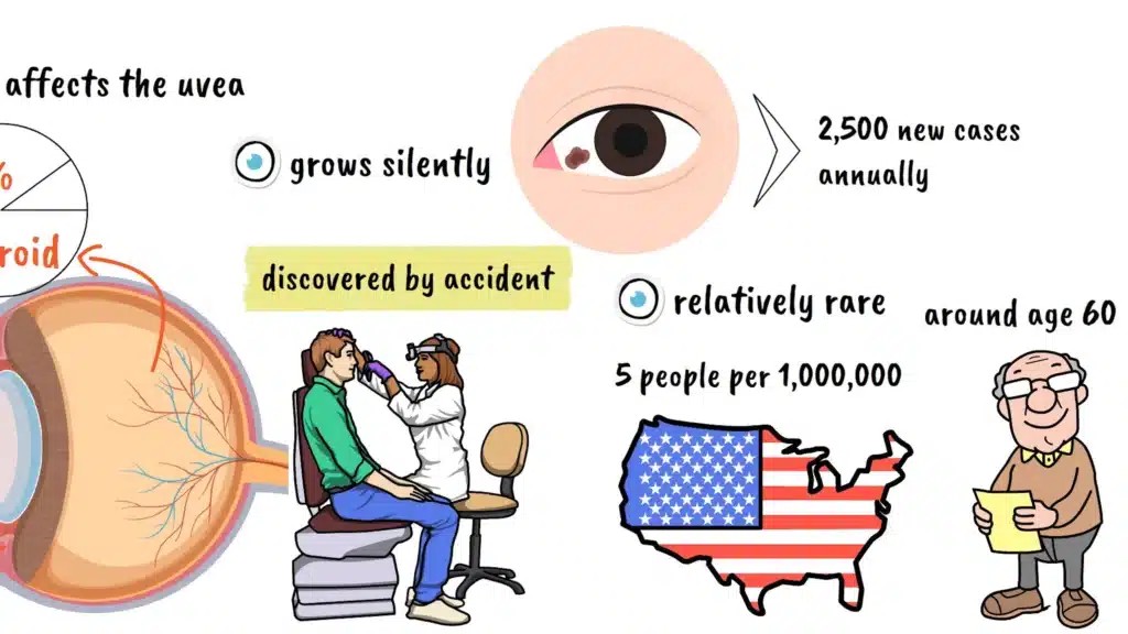 What is Ocular Melanoma