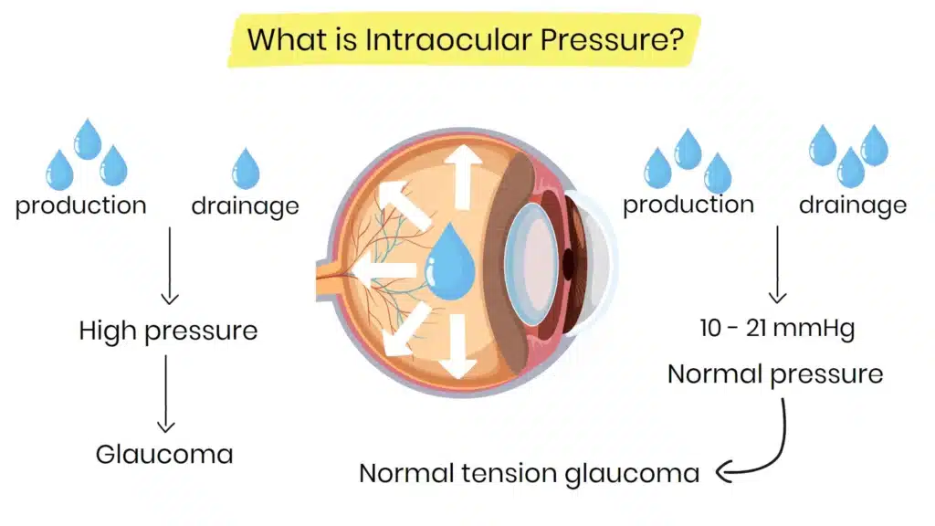 What is intraocular pressure