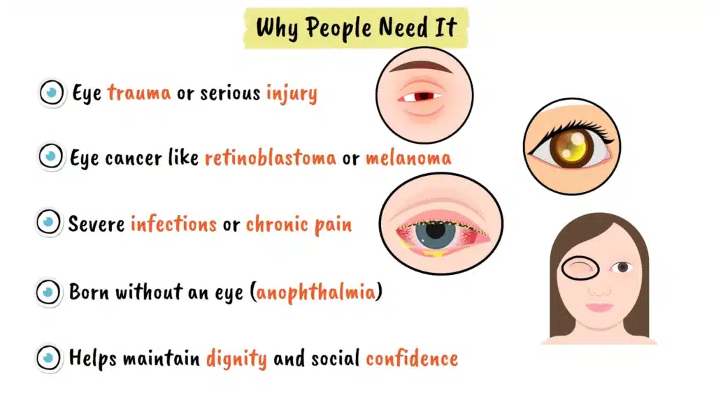 When people need Ocular Prosthesis