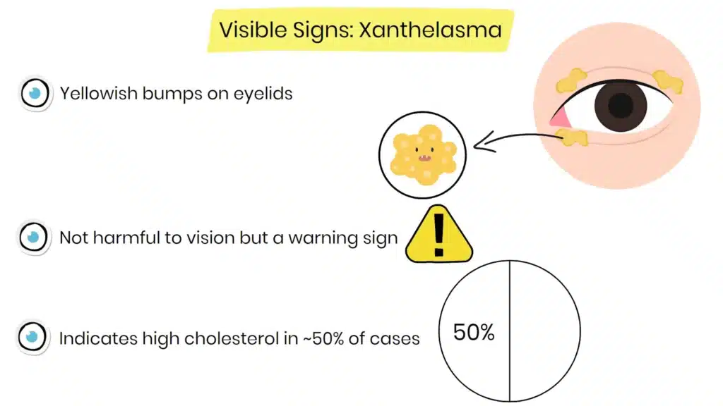 xanthelasma