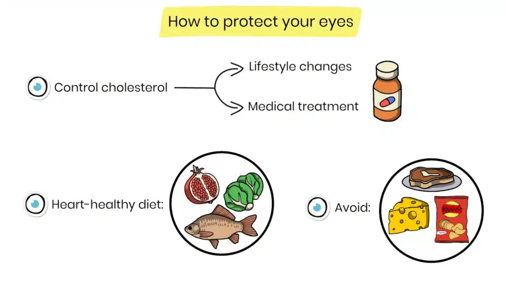 How to protect your eyes from high cholesterol