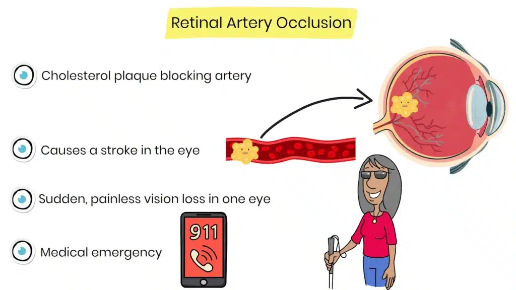 Retinal artery occlusion