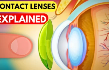 Contact Lenses: Types, Uses & Care
