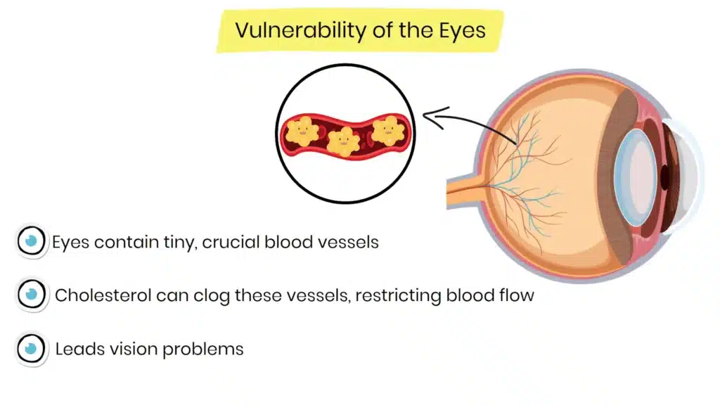 vulnerability of the eyes