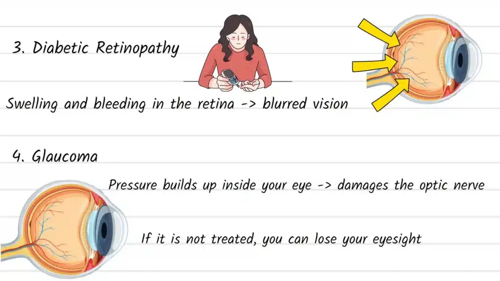 Causes of Blurred Vision diabetic retinopathy and glaucoma
