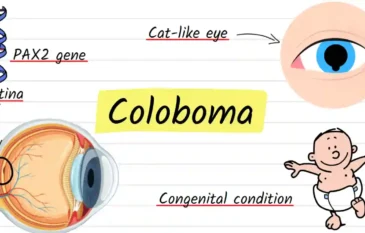 What Is Coloboma?