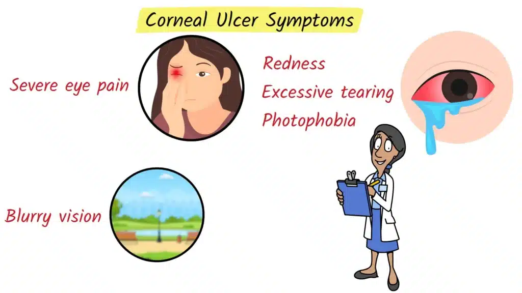 Corneal Ulcer symptoms