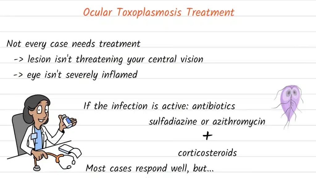 Ocular Toxoplasmosis treatment