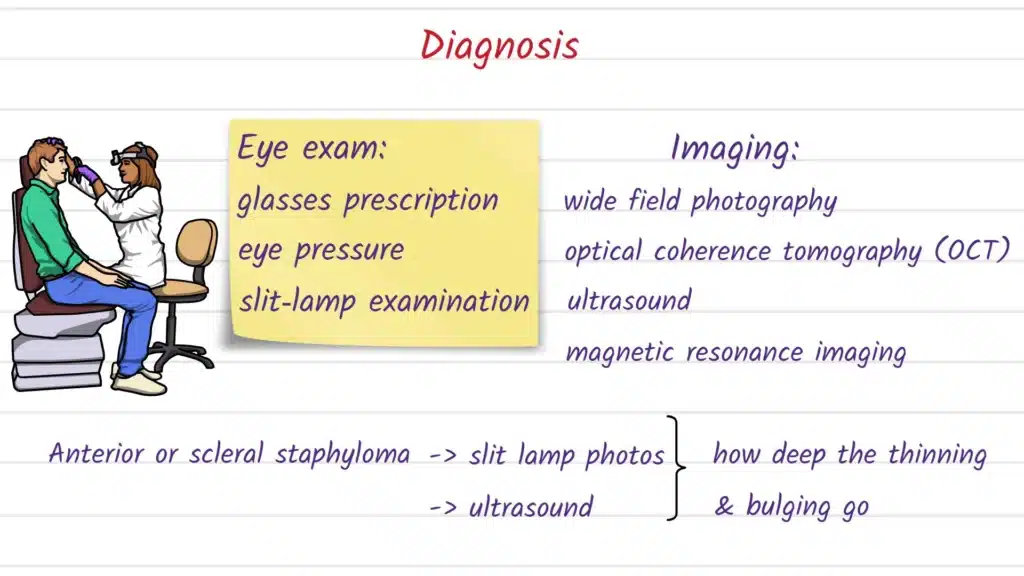 Staphyloma Diagnosis