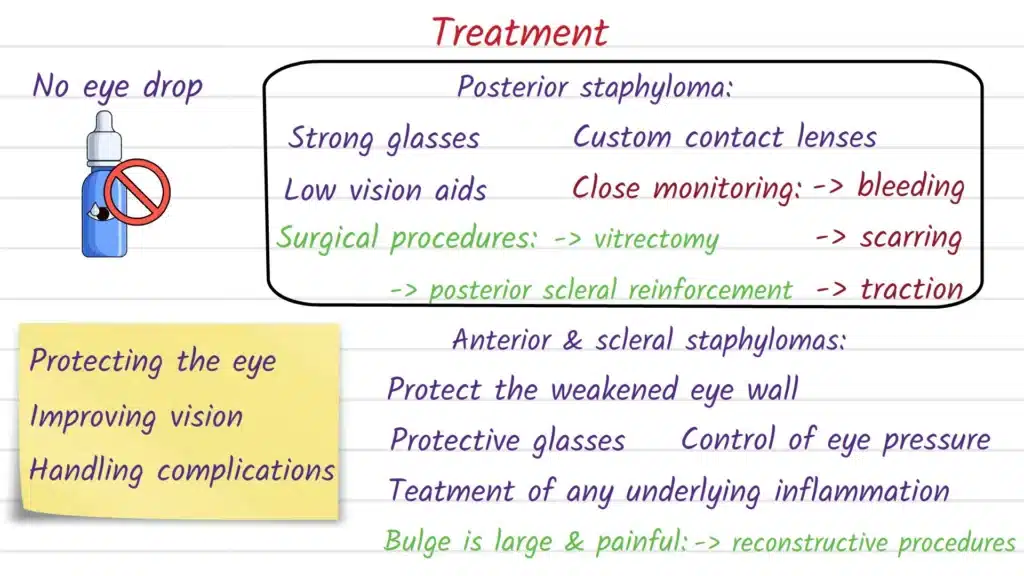 Staphyloma Treatment