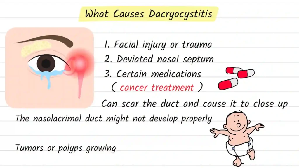 What causes Dacryocystitis