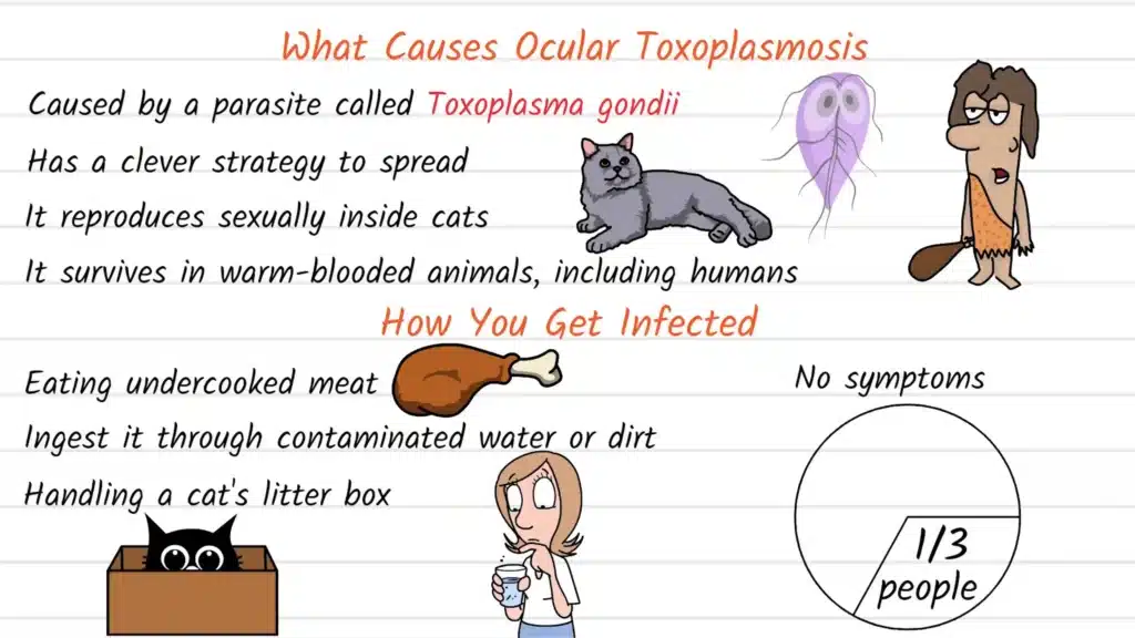 What causes Ocular Toxoplasmosis