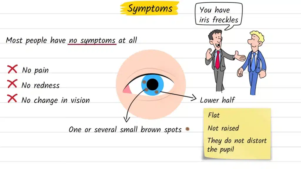 Iris Freckles Symptoms