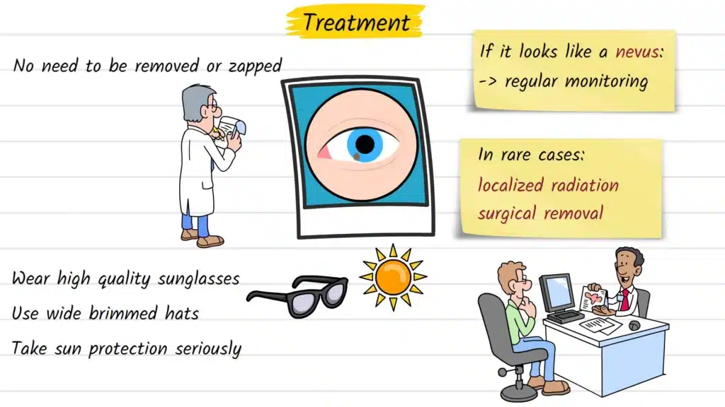 Iris Freckles Treatment