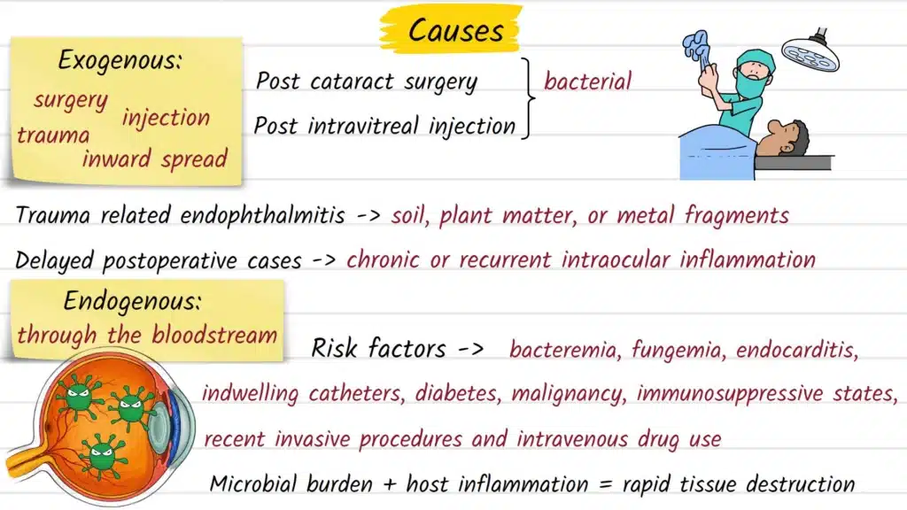 Endophthalmitis Causes