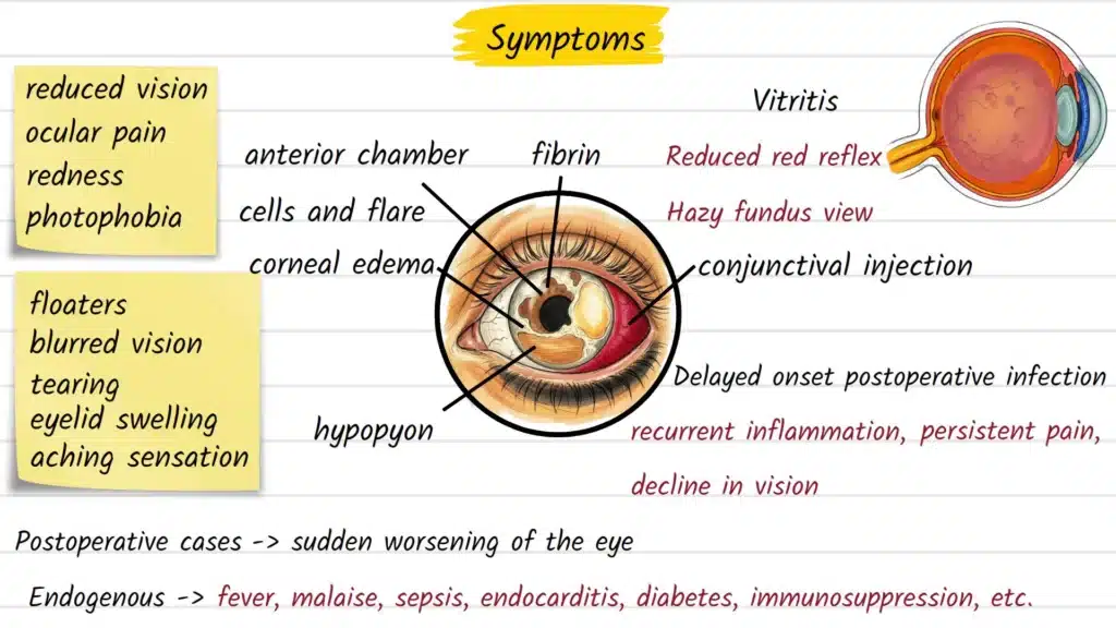 Endophthalmitis Symptoms
