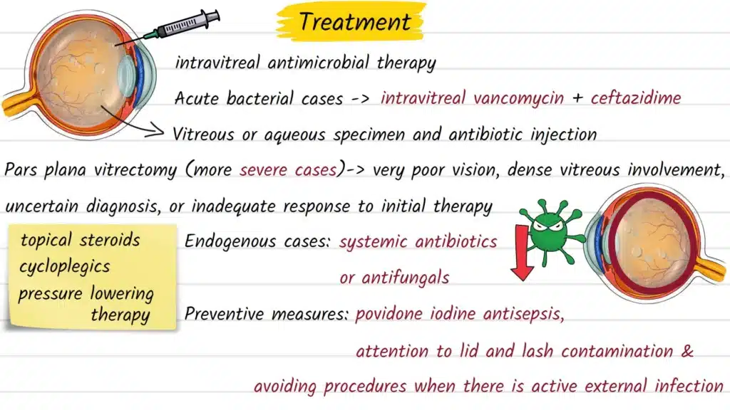 Endophthalmitis Treatment